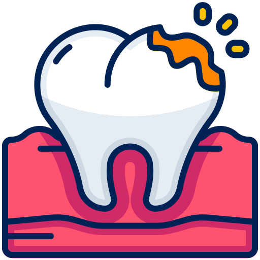 Knocked-Out Tooth
