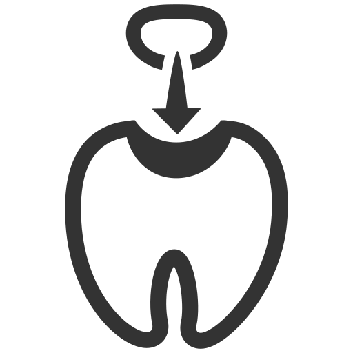 Composite (Tooth-Coloured) Fillings