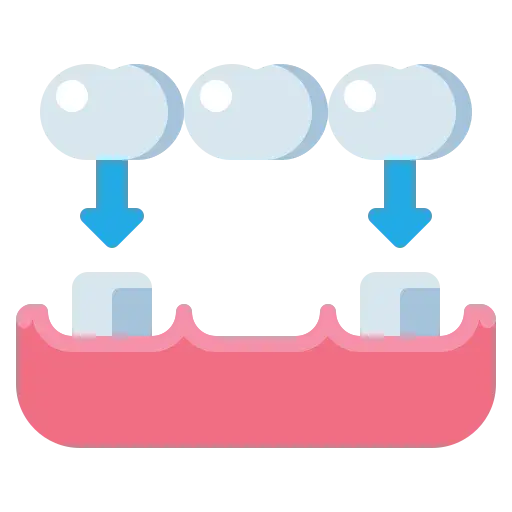 Dental crown and bridge restorations
