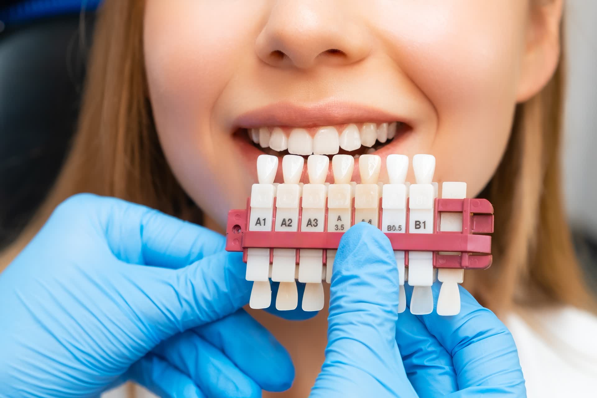 Professional teeth whitening process