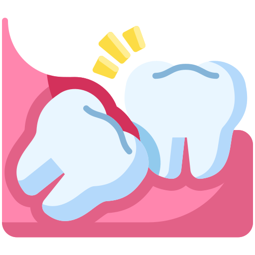 Wisdom Teeth Removal